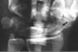 2004 01 07 14 57 38 706