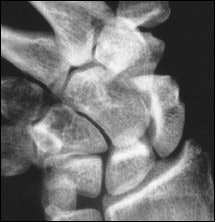 2004 01 07 15 08 38 706