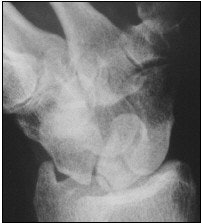 2004 01 07 15 21 18 706