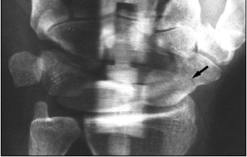 2004 01 07 15 24 07 706