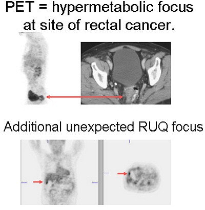 2004 01 12 10 22 36 706