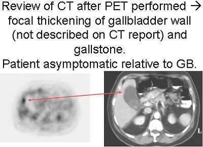 2004 01 12 10 24 14 706