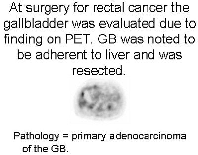 2004 01 12 10 25 35 706