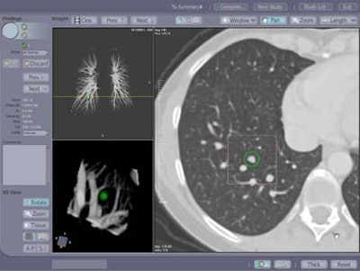 2004 01 23 17 01 00 706