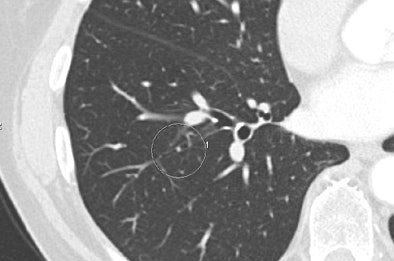 2004 01 23 17 02 25 706