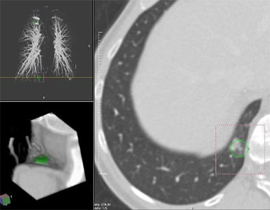 2004 01 23 17 11 22 706