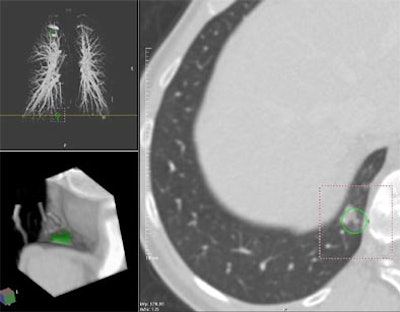 2004 01 23 17 11 22 706