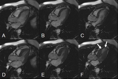 2004 01 30 15 22 25 706