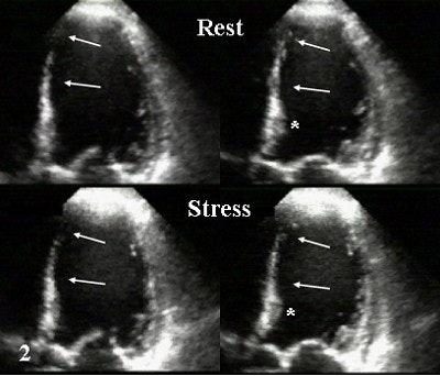 2004 01 30 15 26 24 706