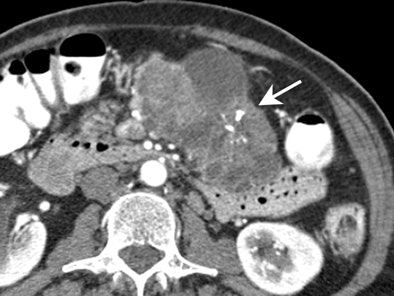 2004 02 04 16 58 14 706