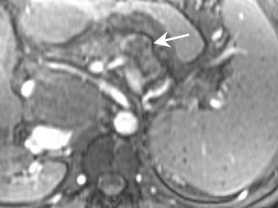 2004 02 04 16 58 55 706