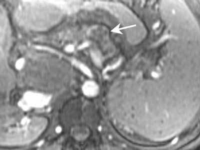 2004 02 04 16 58 55 706