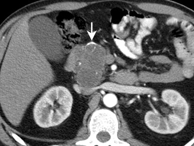 2004 02 04 16 59 41 706