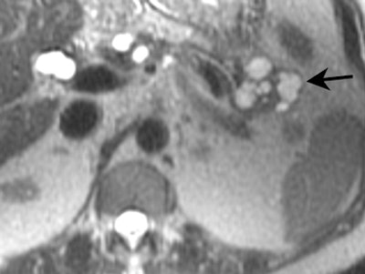 2004 02 04 17 01 15 706