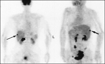 2004 02 10 17 01 50 706