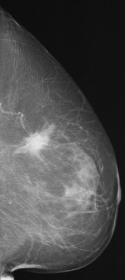 2004 02 20 17 06 01 706