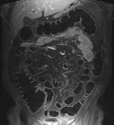 2004 02 23 18 52 58 706