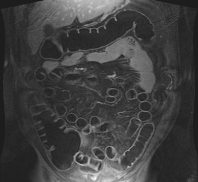 2004 02 23 18 54 20 706