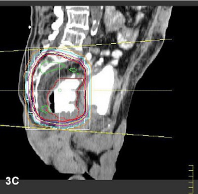 2004 02 24 16 51 43 706