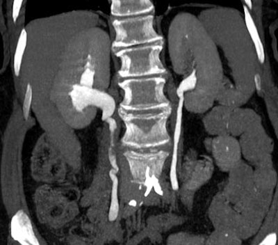 2004 02 27 18 24 33 706