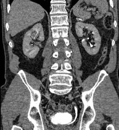 2004 02 27 18 25 34 706