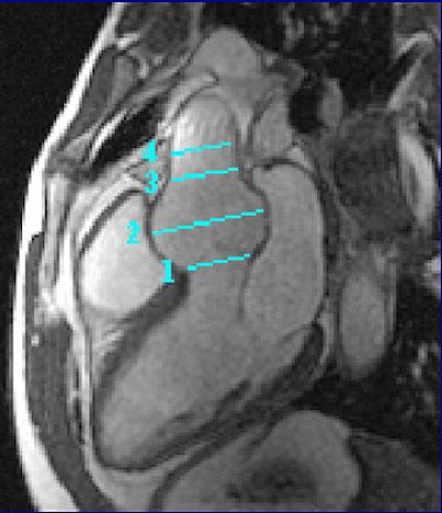 2004 03 01 10 22 02 706