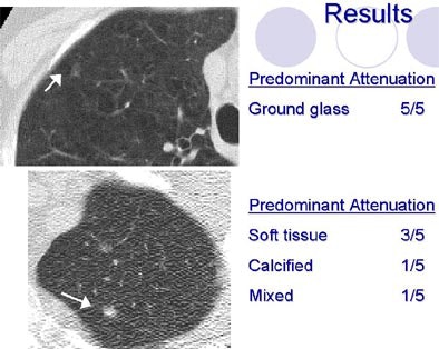 2004 03 01 12 37 15 706