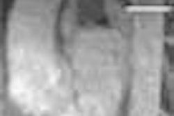 2004 03 02 06 11 01 706