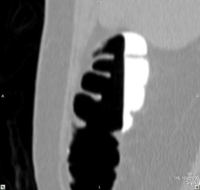 2004 03 02 11 56 53 706