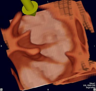 2004 03 02 12 01 03 706