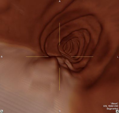 2004 03 02 12 01 50 706