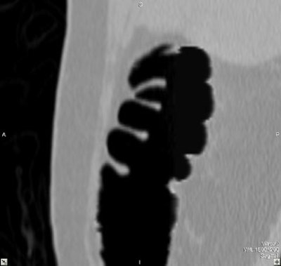 2004 03 02 12 02 38 706