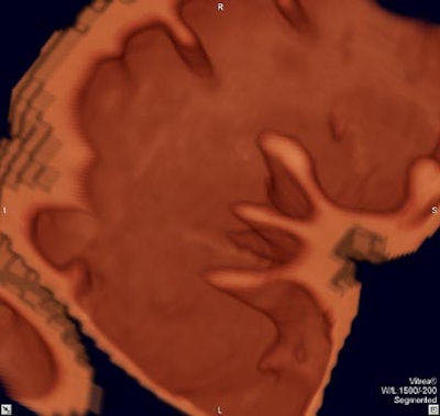 2004 03 02 12 03 23 706