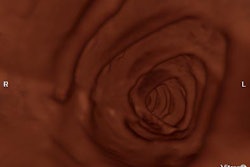 2004 03 02 12 06 44 706