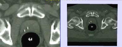 2004 03 05 11 51 51 706