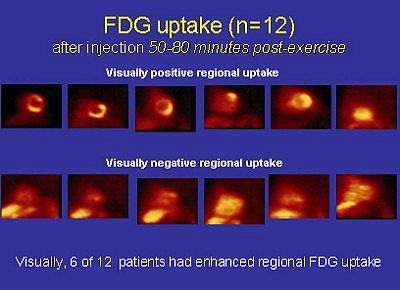 2004 03 09 12 25 54 706