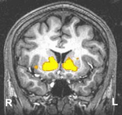 2004 03 15 11 12 02 706