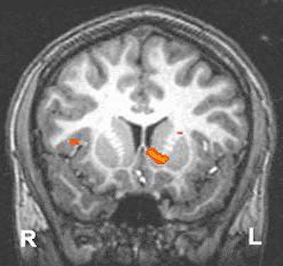 2004 03 15 11 14 43 706