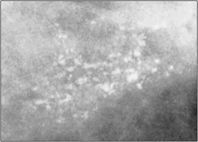 2004 03 15 17 05 20 706