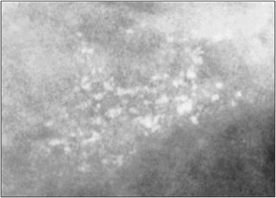 2004 03 15 17 05 20 706