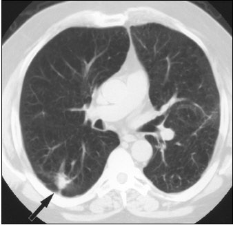 2004 04 05 10 38 12 706