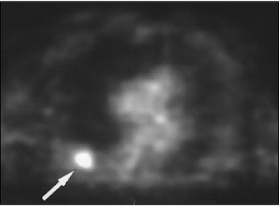 2004 04 05 10 40 11 706