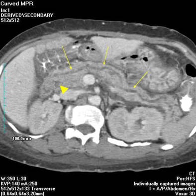 2004 04 13 17 19 47 706