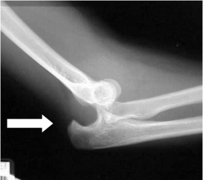 2004 04 23 16 22 08 706