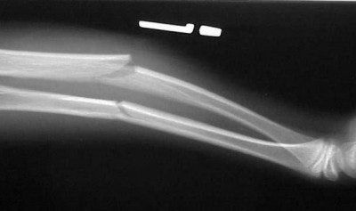 2004 04 23 16 27 04 706