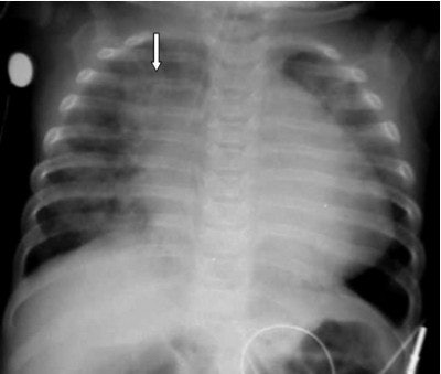 2004 04 23 16 27 21 706