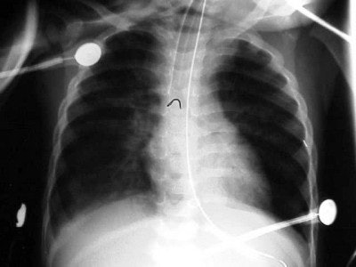 2004 04 23 16 27 37 706