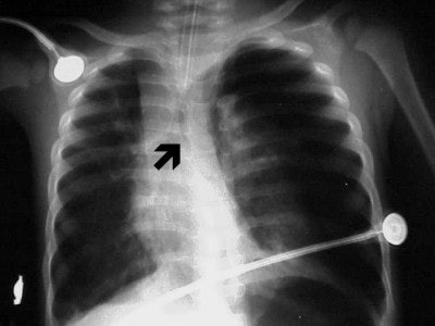 2004 04 23 16 27 57 706