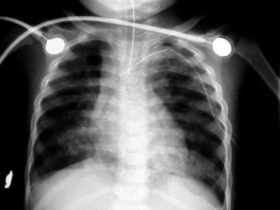 2004 04 23 16 28 12 706