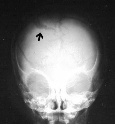 2004 04 23 16 28 27 706